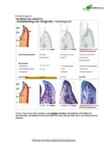 Korte samenvatting – Parodontium 1